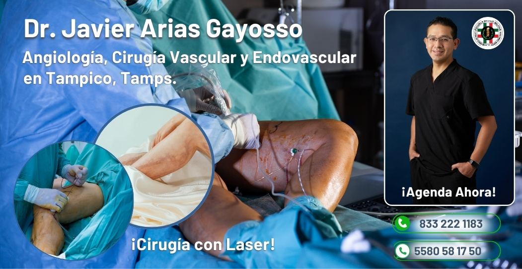 Angiólogo Dr. Javier Arias Gayosso Angiólogo Dr. Javier Arias Gayosso
