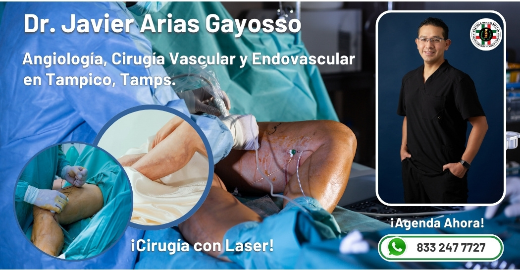 Angiólogo Dr. Javier Arias Gayosso